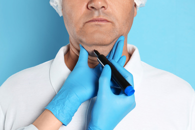 Surgeon with marker preparing man for operation against blue background, closeup. Double chin removal