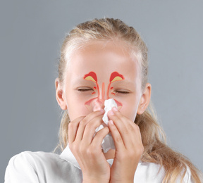 Little girl suffering from runny nose as allergy symptom. Sinuses illustration on face