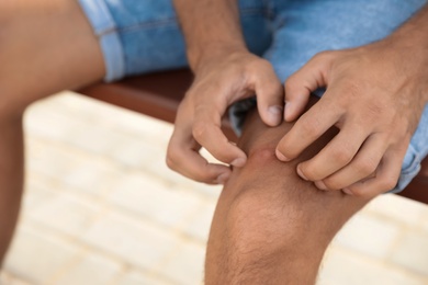 Man scratching leg with insect bites on bench outdoors, closeup