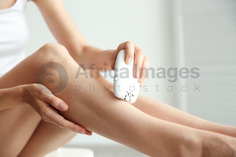 Woman doing leg epilation procedure on light background, closeup