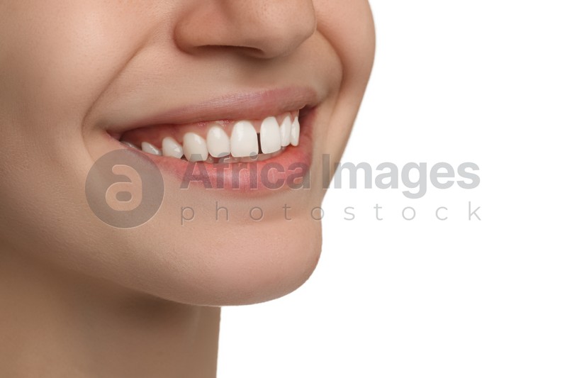 Woman with diastema between upper front teeth on white background, closeup