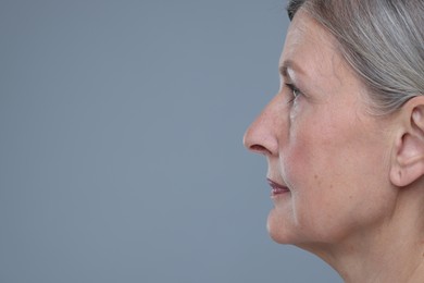 Photo of Senior woman with aging skin on grey background, closeup and space for text. Rejuvenation treatment