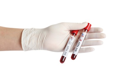 Scientist holding tubes with blood samples and labels HIV Test on white background, closeup