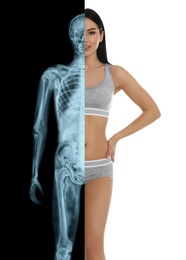 Woman in underwear, half x-ray photograph. Medical check