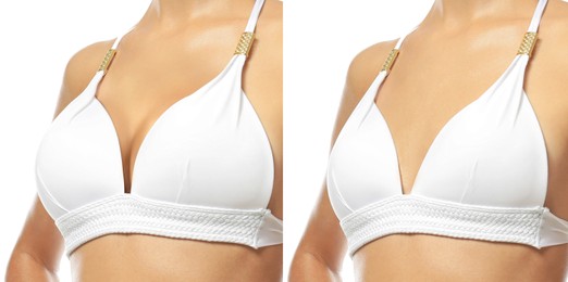 Collage with photos of young woman before and after breast size correction on white background, closeup. Banner design