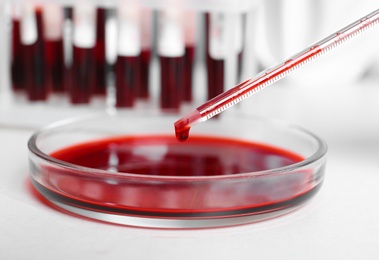 Pipetting blood into Petri dish for analysis on table in laboratory, closeup