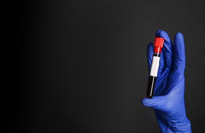 Scientist holding test tube with blood sample and label CORONA VIRUS on black background, closeup. Space for text