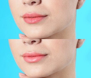 Image of Collage with photos of woman before and after using lip balm on light blue background, closeup