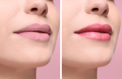 Collage with photos of woman with dry and moisturized lips, closeup