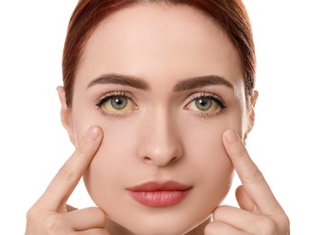Woman with yellow eyes on white background. Symptom of hepatitis