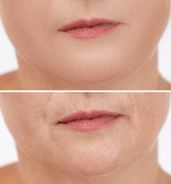 Collage with photos of mature woman having dry skin problem before and after moisturizing, closeup