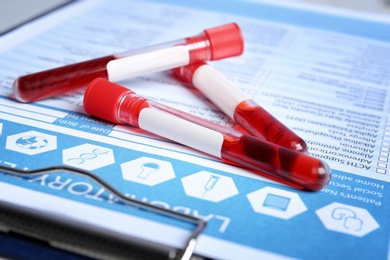 Sample tubes with blood on laboratory test form, closeup. Research and analysis