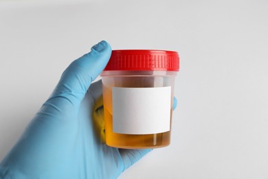 Photo of Nurse holding container with urine sample for analysis on white background, closeup