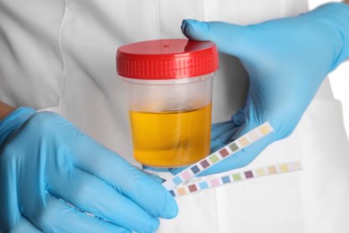 Photo of Nurse holding test strips and container with urine sample for analysis, closeup