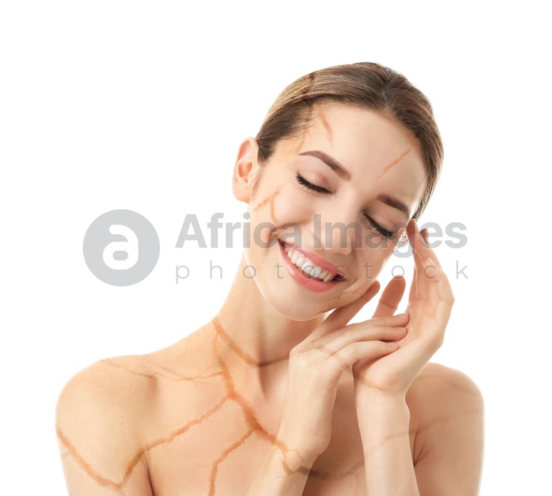 Young woman with body dry skin problem on white background