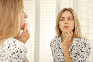 Photo of Woman with herpes applying cream onto lip near mirror at home