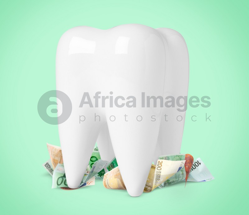 Model of tooth and euro banknotes on turquoise background. Concept of expensive dental procedures