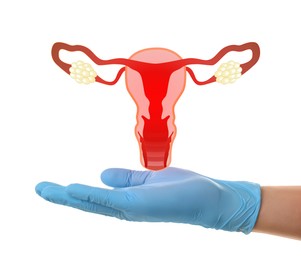 Doctor demonstrating virtual icon with illustration of female reproductive system on white background, closeup. Gynecological care 
