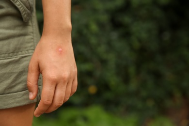 Woman with insect bites on arm in park, closeup. Space for text