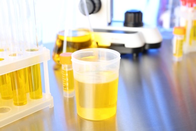 Laboratory ware with samples for urine analysis on table
