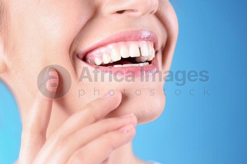 Woman with diastema between upper front teeth on light blue background, closeup