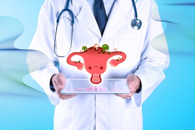 Doctor with tablet and virtual image of infected female reproductive system on turquoise background, closeup. Vaginal candidiasis