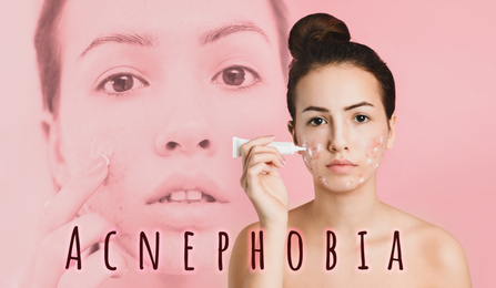 Teenage girl with problem skin applying cream on light pink background. Acnephobia
