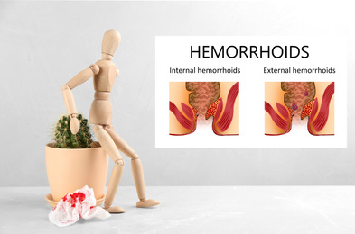 Hemorrhoids. Wooden human figure near cactus and illustrations of unhealthy lower rectum