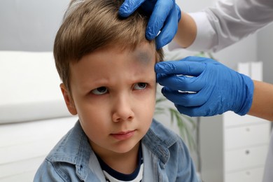 Doctor checking boy's forehead with bruise at hospital, closeup