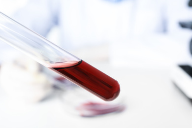 Test tube with blood sample on blurred background, closeup. Virus research