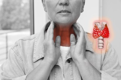 Mature woman with thyroid gland disease indoors