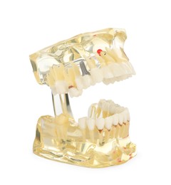 Educational dental typodont model isolated on white