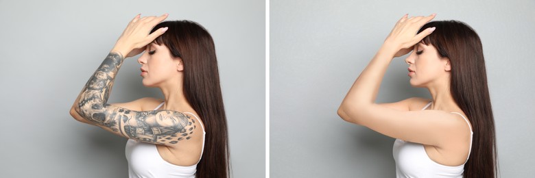 Woman before and after laser tattoo removal procedure on light grey background. Collage with photos, banner design