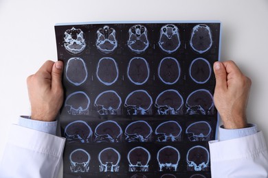 Doctor examining MRI images of patient with multiple sclerosis at white table, top view
