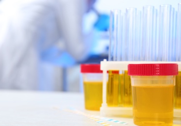 Containers with urine samples on table in laboratory, space for text. Medical analysis