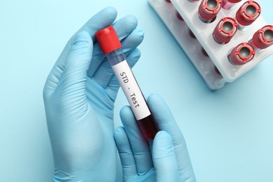 Scientist holding tube with blood sample and label STD Test on light blue background, top view