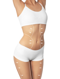 Slim young woman with marks on body for cosmetic surgery operation against white background, closeup