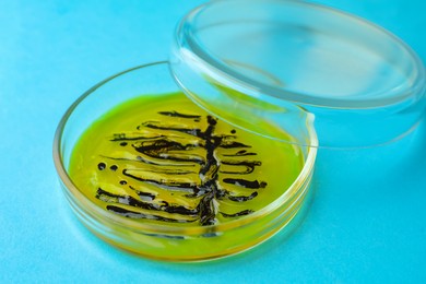 Photo of Petri dish with culture on light blue background, closeup