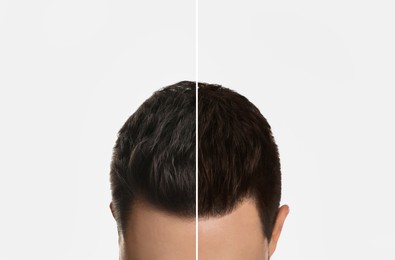 Image of Closeup view of man before and after hair dyeing on light background, collage