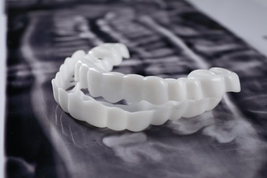 Photo of Mouth guards on dental scan, closeup. Bite correction