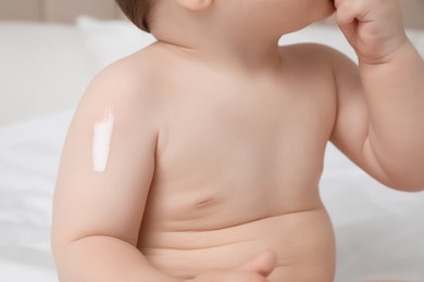 Cute little baby with cream on arm, closeup