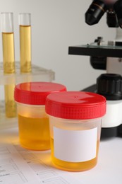 Containers with urine samples for analysis on table in laboratory