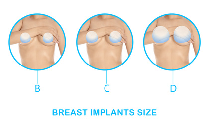 Collage with photos of woman demonstrating different implant sizes for breast on white background, closeup. Banner design 
