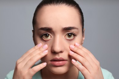 Woman checking her health condition on grey background. Yellow eyes as symptom of problems with liver
