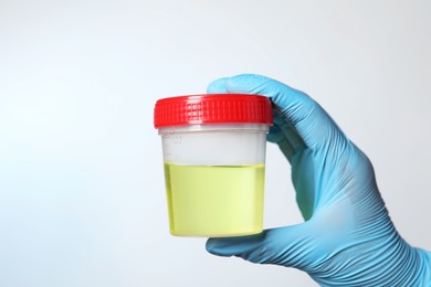 Doctor holding container with urine sample for analysis on white background, closeup