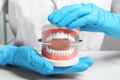 Dentist holding educational model of oral cavity with teeth at workplace, closeup