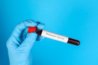 Photo of Monkeypox virus diagnosis. Laboratory worker holding test tube with blood sample on light blue background, closeup