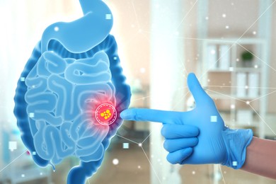 Image of Gastroenterologist pointing at virtual image of intestine with inflammation indoors, closeup