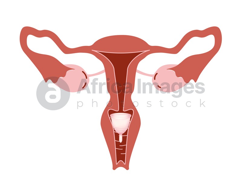 Instruction how to use menstrual cup during period. Female reproductive system on white background, illustration