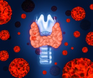 Illustration of human thyroid cancer on blue background